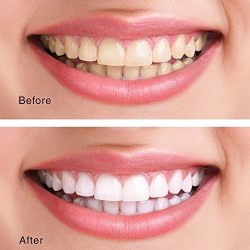 Charcoal Teeth Whitening Powder - Made in USA