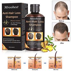 Anti-Hair Loss Shampoo, Hair Regrowth Shampoo, Natural Old Ginger Hair