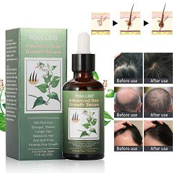 Hair Growth Serum, Hair Loss Treatments, Hair Serum, Hair Growth Oil