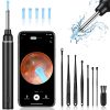 Ear Wax Removal with Live Camera. How to Clean Ears corectly