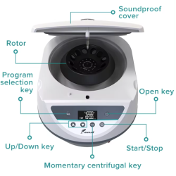 Digital Blood Centrifuge with Safety Lid-Lock & Multiple Rotor Options – Perfect for PRP and Plasma Separation in Medical Labs